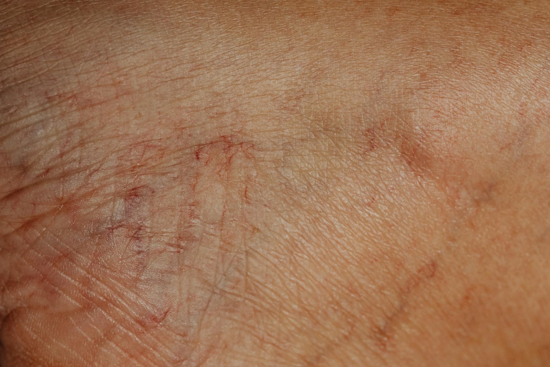 Zbliżenie pomarszczonej, dojrzałej skóry głowy z widoczną teksturą